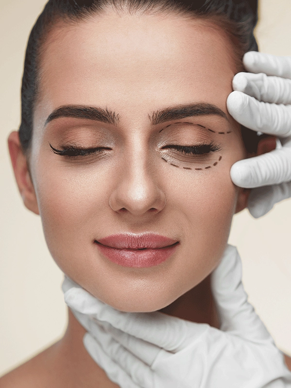 Blepharoplasty