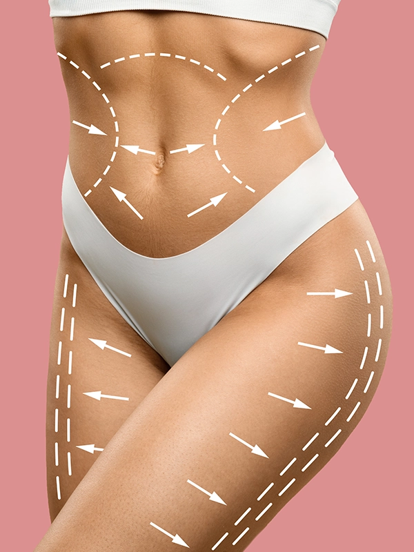 Body Contouring