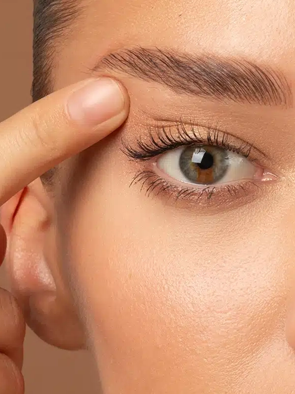 Brow Lift