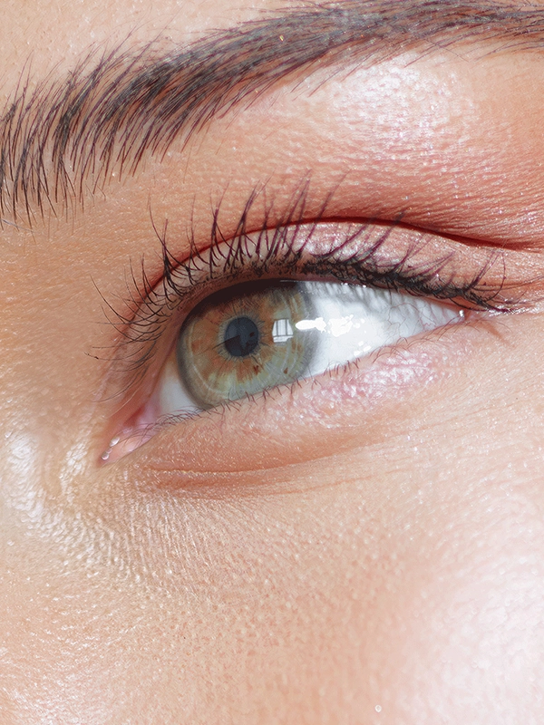 Cat Eye Surgery