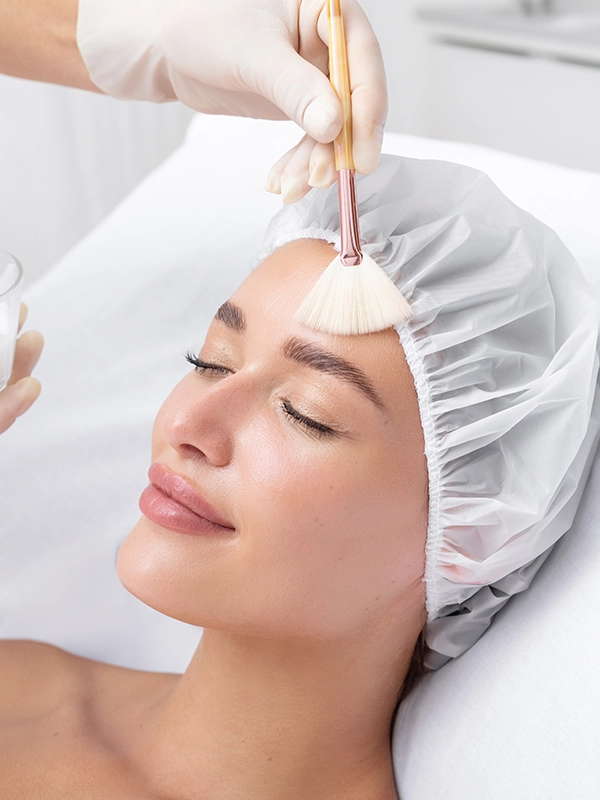 Chemical Peels