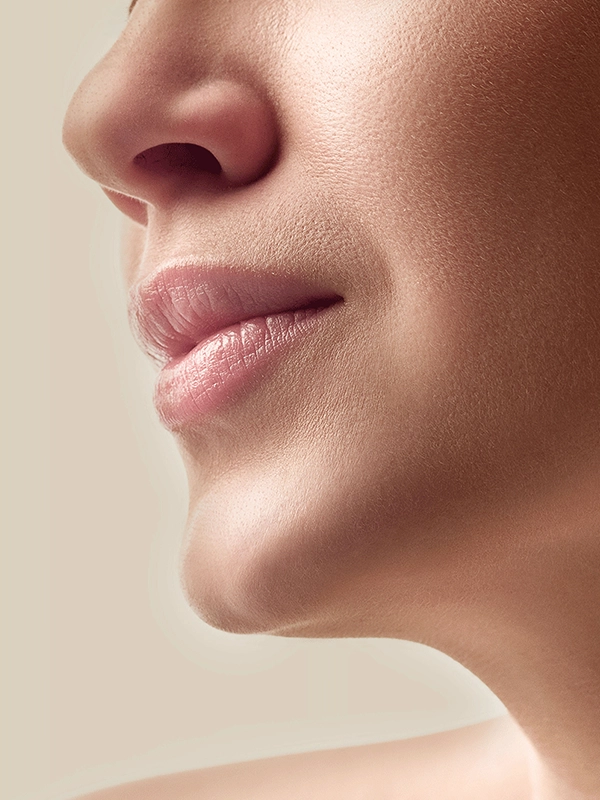 Chin Implant