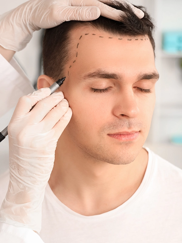 Hair Transplantation