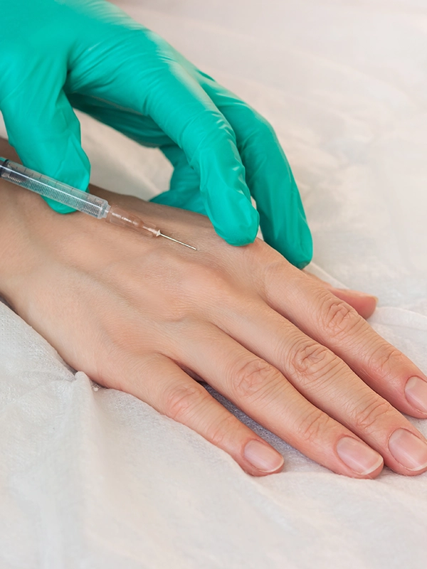 Hand Rejuvenation