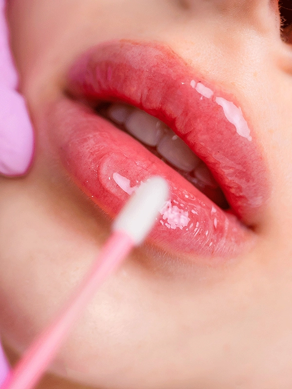 Lip Lift
