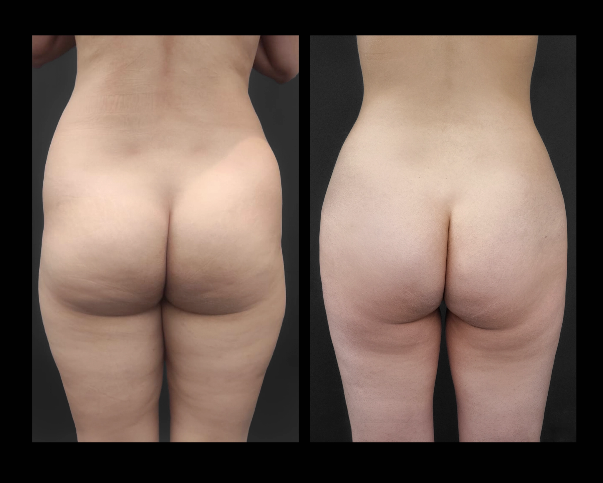 Before and After