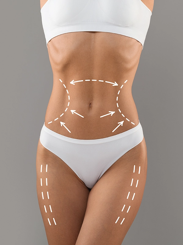 Body Procedures