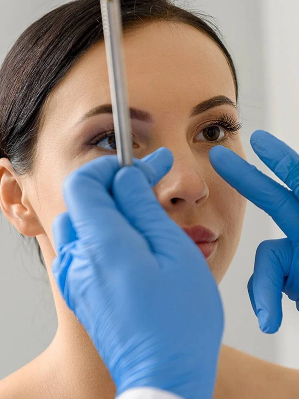 Septoplasty