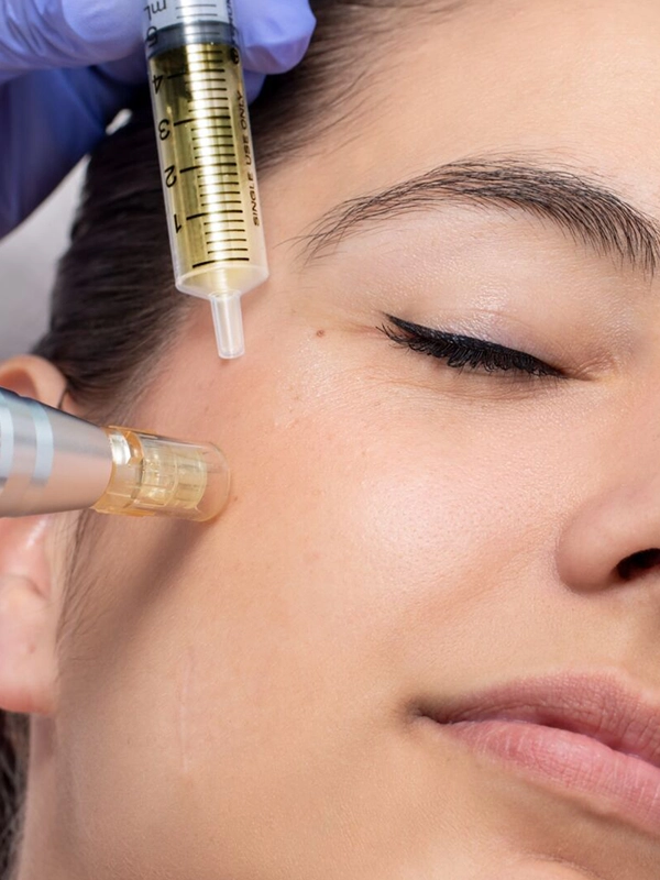 Skin Boosters